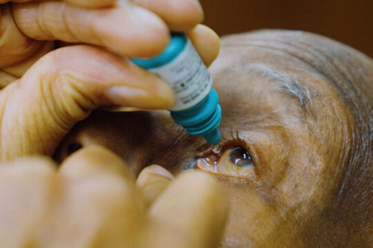 Treating Glaucoma With Medication